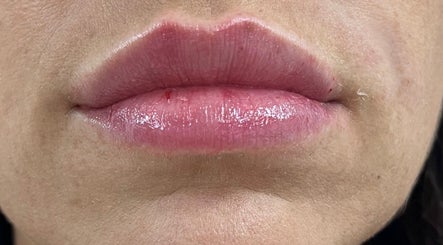 Close-up of lips with gloss at Natalie Mcintyre Aesthetics, Bishopbriggs, Scotland, GB.
