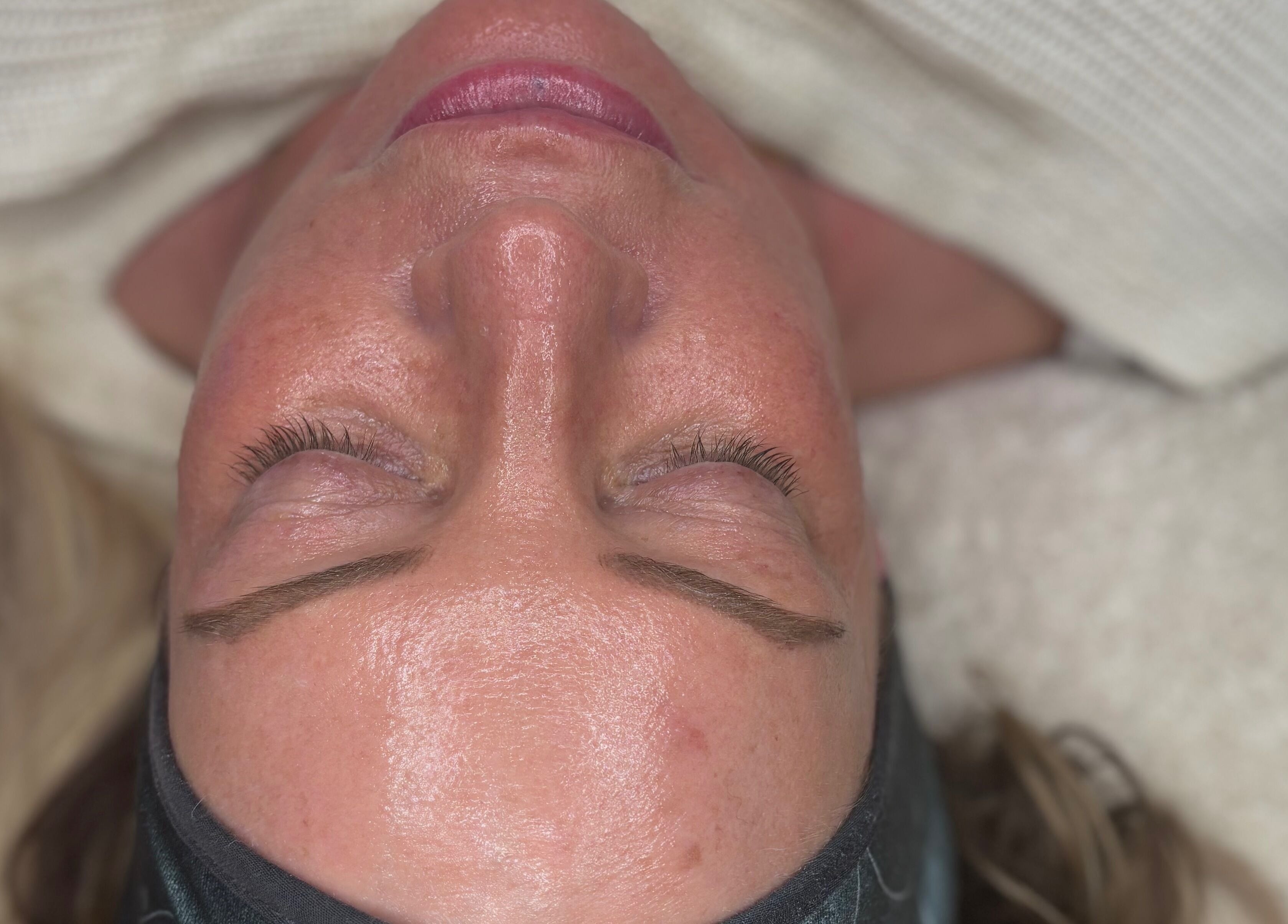 Close-up of a serene face receiving a treatment at Natalie Mcintyre Aesthetics, Bishopbriggs, Scotland, GB.