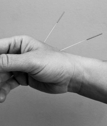 Nature's Chinese Medicine & Acupuncture Clinic Geraldton изображение 2