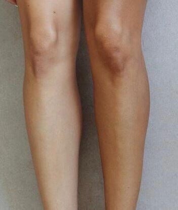 Comparison of tanned and untanned legs at Bare Tan Spray Tanning in Jeffreys Bay, Eastern Cape, ZA.