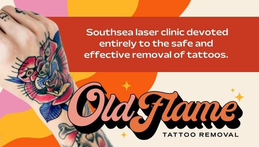 Old Flame Tattoo Removal slika 1