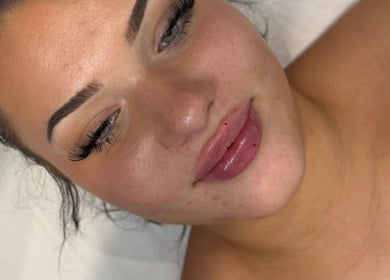 Close-up of a woman's face showcasing beauty treatment at Twelve34 Aesthetics, Luton, England, GB.