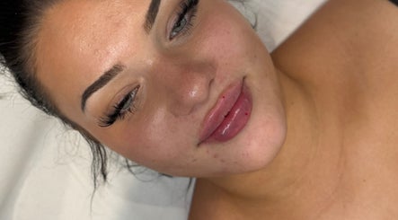 Close-up of a woman's face showcasing beauty treatment at Twelve34 Aesthetics, Luton, England, GB.