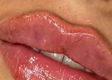 Close-up of glossy lips after treatment at Twelve34 Aesthetics, Luton, England, GB.
