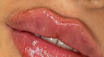 Close-up of glossy lips after treatment at Twelve34 Aesthetics, Luton, England, GB.
