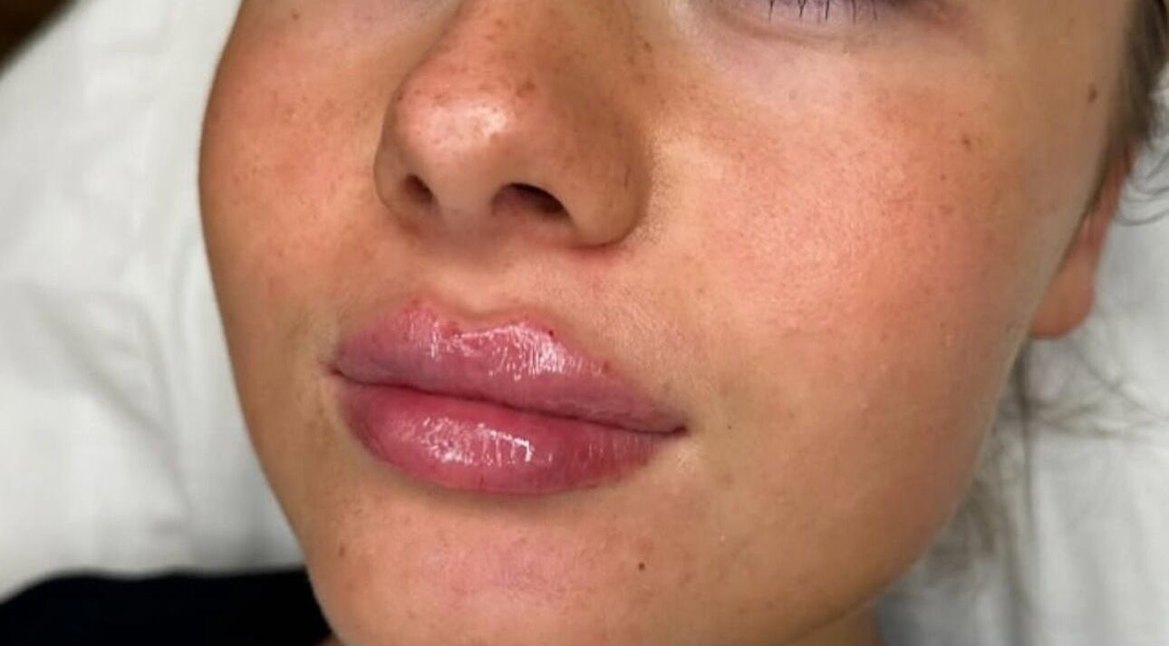 Luminous lips treatment at Gorjess Beauty, Accrington, England, GB showcases smooth and shiny lip finish.