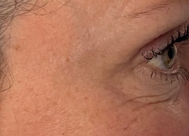 Close-up of an eye showing detailed skin and lashes at Aesthetics by Hayley, London, England, GB.