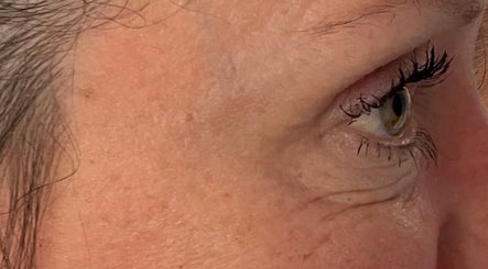 Close-up of an eye showing detailed skin and lashes at Aesthetics by Hayley, London, England, GB.