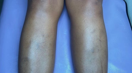 Smooth legs after treatment at Aesthetic Haven in Saint James, offering premium wellness services.