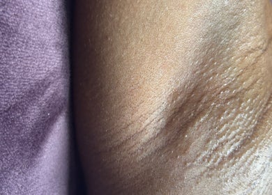 Close-up of skin texture at Aesthetic Haven, Saint James, Saint James, BB, highlighting natural wellness.