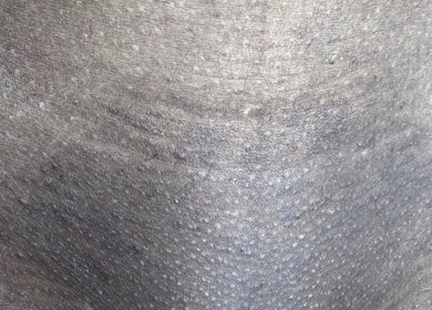 Detailed close-up of textured skin surface at Aesthetic Haven, Saint James, BB.