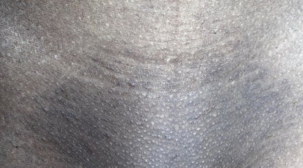 Detailed close-up of textured skin surface at Aesthetic Haven, Saint James, BB.