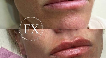 FX Aesthetics and Beauty – kuva 3
