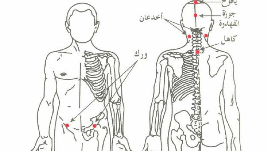 Holistic Hijama Shameel slika 1