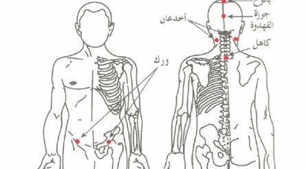 Holistic Hijama Shameel