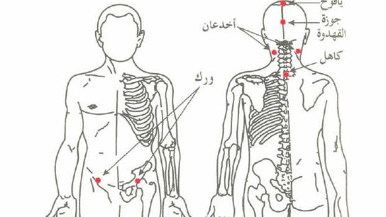 Holistic Hijama Shameel