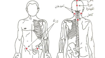 Holistic Hijama Shameel slika 3