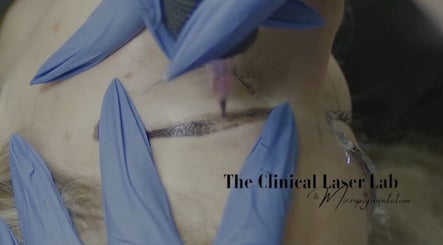 The Clinical Laser Lab and Micropigmentation image 3