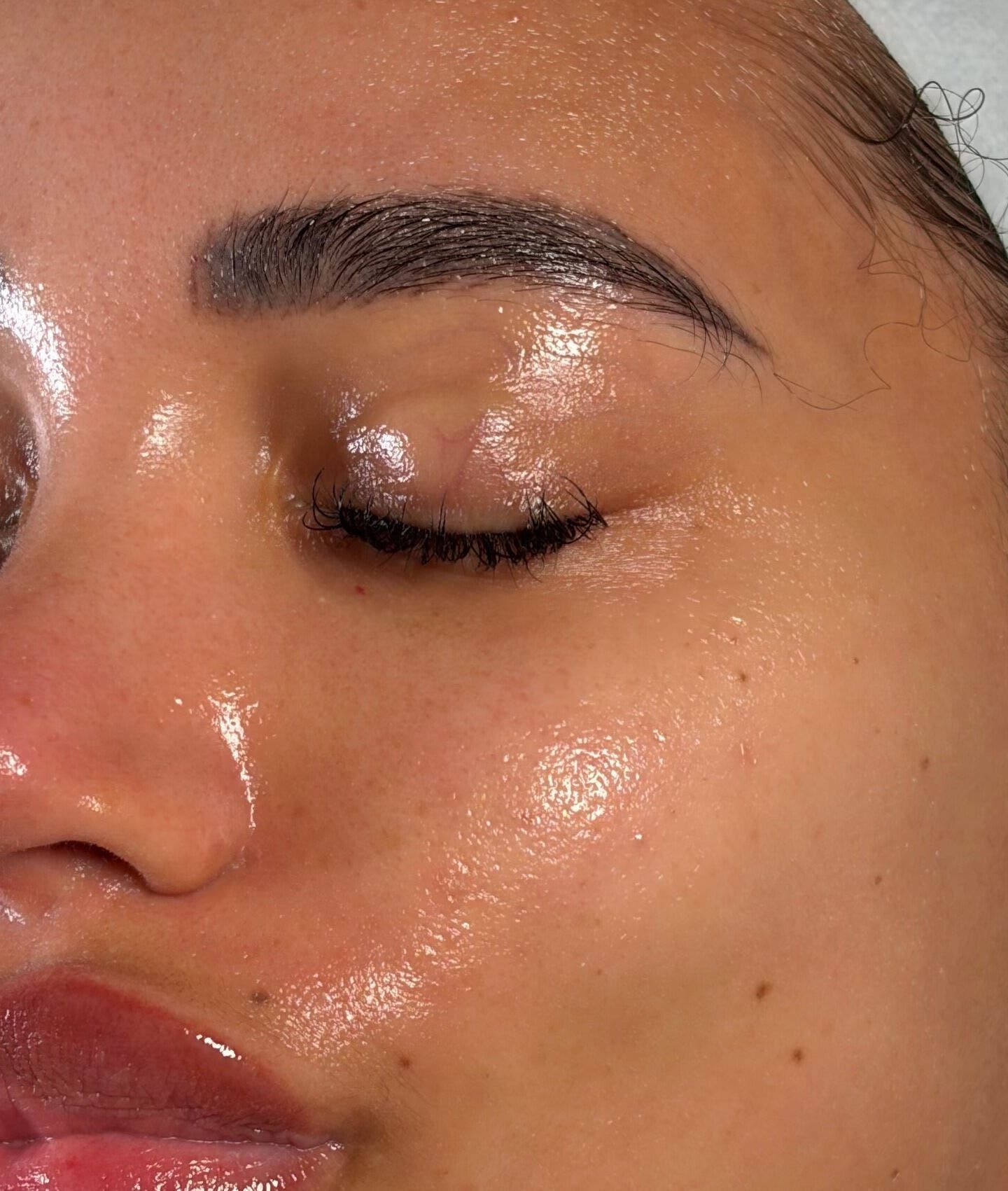 Close-up of glowing skin from facial treatment at SDK Studio, Liverpool, England, GB.