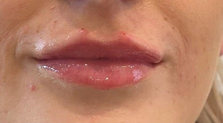 Revitalise Aesthetics Clinic image 2