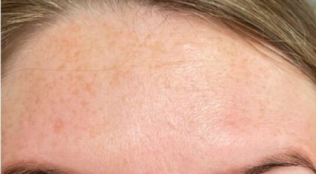 Revitalise Aesthetics Clinic image 3