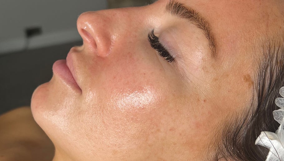 Immagine 1, IV Skin Clinic