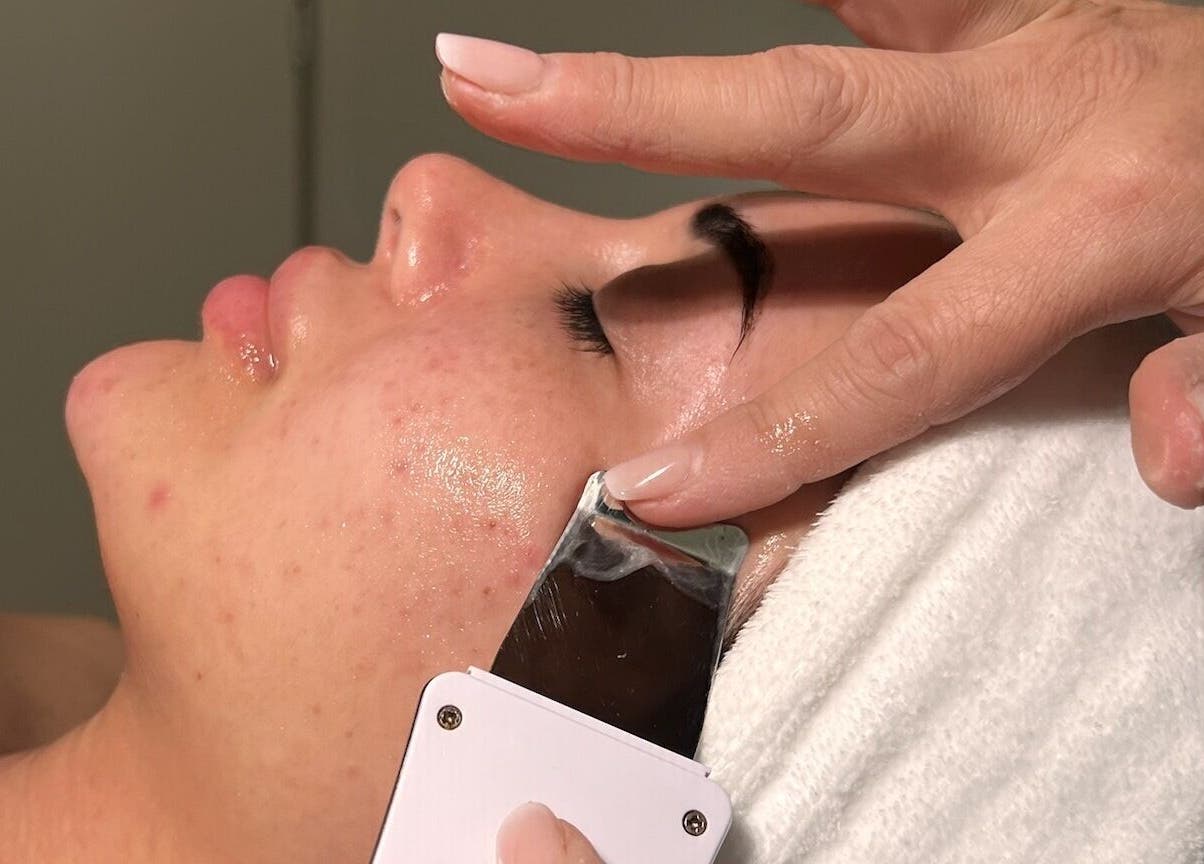 Facial treatment at Ministry of Beauté, Kingsgrove, New South Wales, AU enhancing skin glow and rejuvenation.