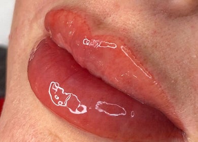 Close-up of glossy lips showcasing expert beauty treatment at Poise Studio, Ramsbottom, England, GB.