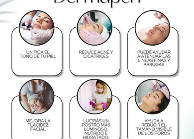 Tratamiento Dermapen en ADESPA, Guayaquil, MEXICO, EC. Mejora la piel y reduce cicatrices.