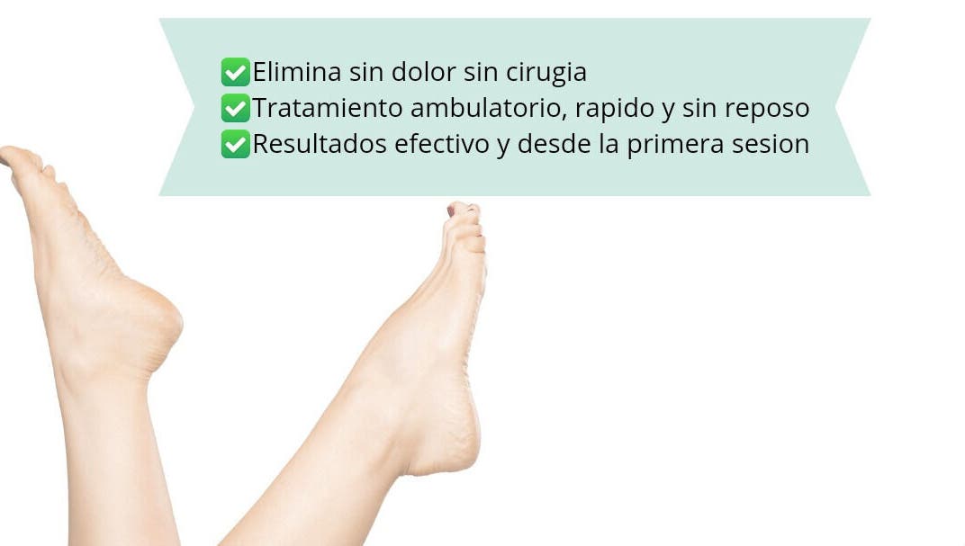 Tratamiento estético de piernas en ADESPA, Guayaquil, GUAYAQUIL, EC, sin dolor ni cirugía.
