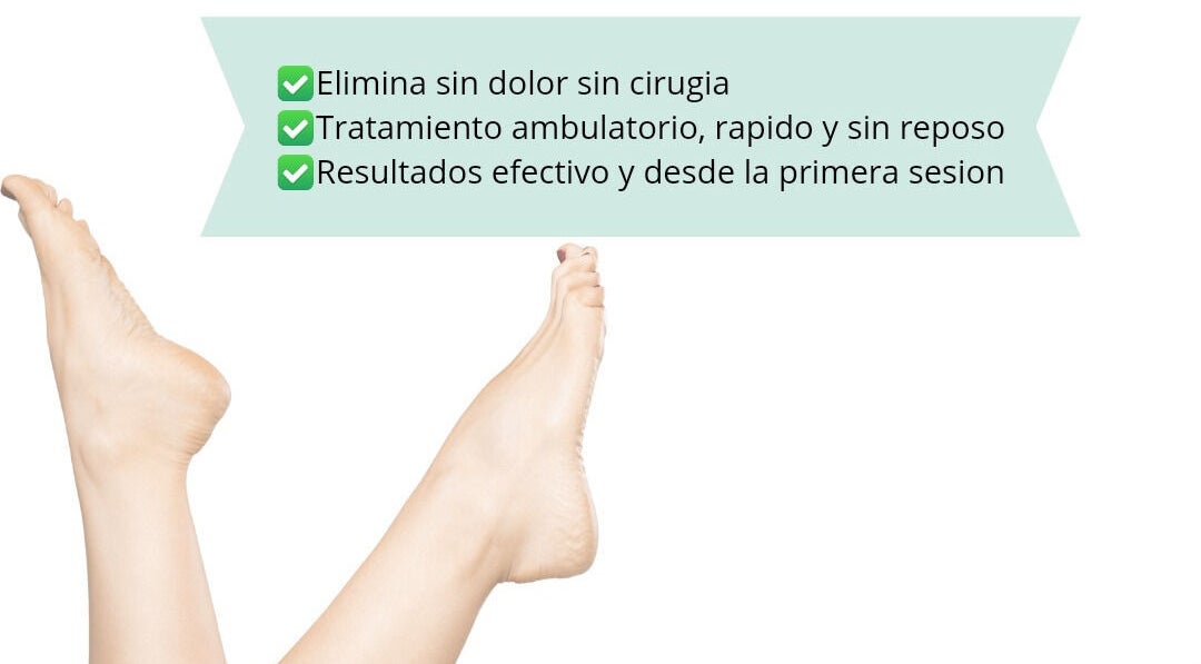Tratamiento estético de piernas en ADESPA, Guayaquil, GUAYAQUIL, EC, sin dolor ni cirugía.