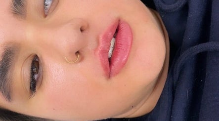 Close-up of radiant, smooth skin at Glow Beauty & Aesthetics, Timperley, England, GB.