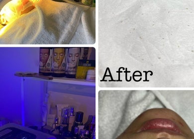 Facial treatment setup at Amelia Beauty in Manchester, England, GB showcasing skincare products and equipment.