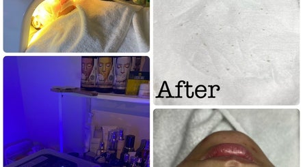 Facial treatment setup at Amelia Beauty in Manchester, England, GB showcasing skincare products and equipment.