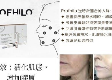 Profhilo treatment info at Amelia Beauty, Manchester, England, GB for skin rejuvenation.