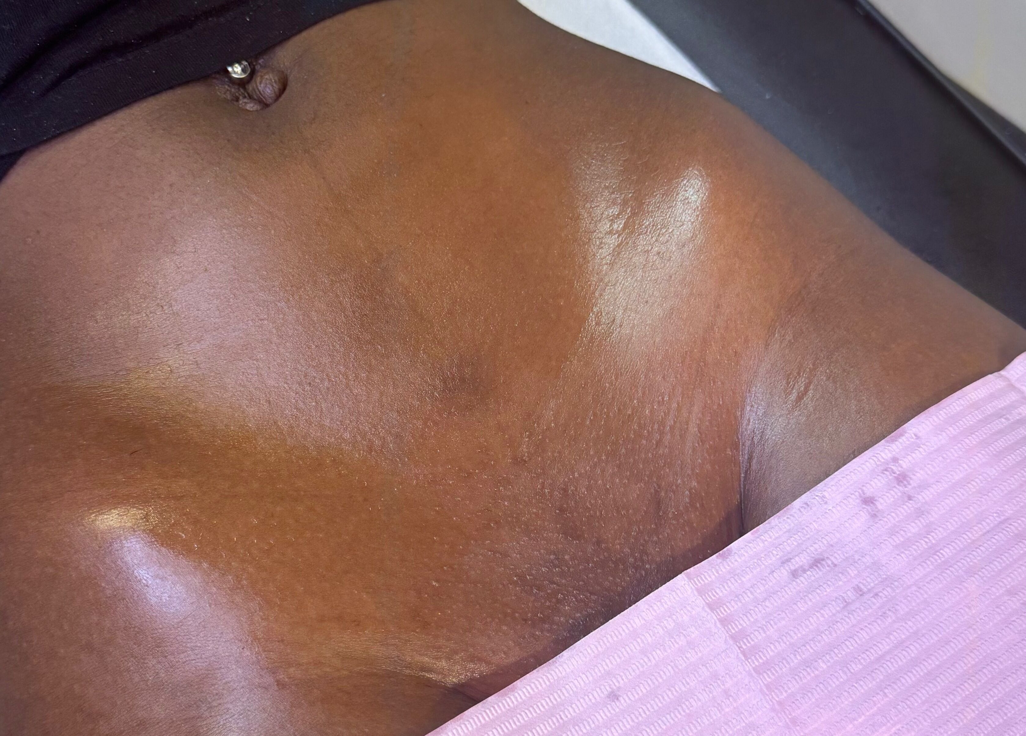 Smooth, glowing skin post-treatment at Skin & Beauty By Ells in Luton, England, GB.