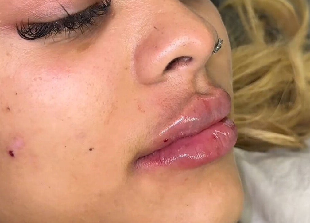 Close-up of hydrated lips after treatment at Skin & Beauty By Ells, Luton, England, GB.