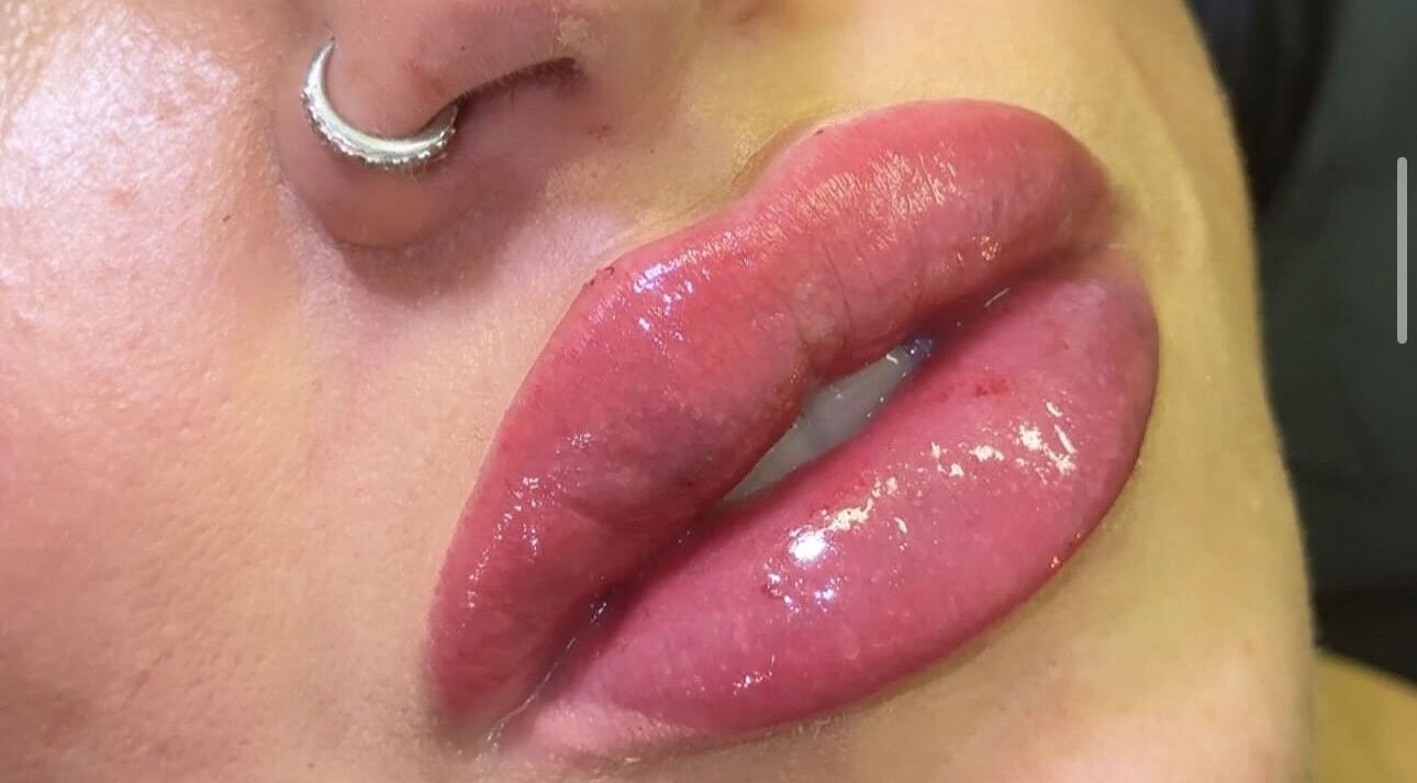 Glossy lips showcasing a beauty treatment at Skin & Beauty By Ells & Ella’s Luxe Aesthetics, LUTON, England, GB.