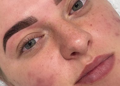 Close-up of a woman's face post-treatment at Celestial Beauty, Oran Park, New South Wales, AU.