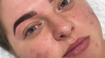 Close-up of a woman's face post-treatment at Celestial Beauty, Oran Park, New South Wales, AU.
