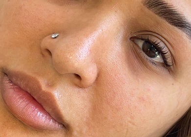 Close-up of a serene face after treatment at Celestial Beauty, Oran Park, New South Wales, AU.