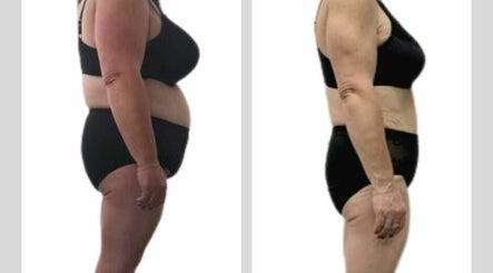 Shrink Revolutionary Fat Loss Without Surgery, bilde 3