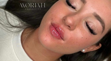 Moriah Aesthetics изображение 2