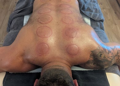 Cupping therapy session at Level Up Massage in Fareham, England, GB for holistic healing and relaxation.