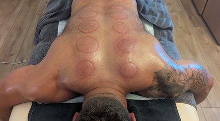 Cupping therapy session at Level Up Massage in Fareham, England, GB for holistic healing and relaxation.