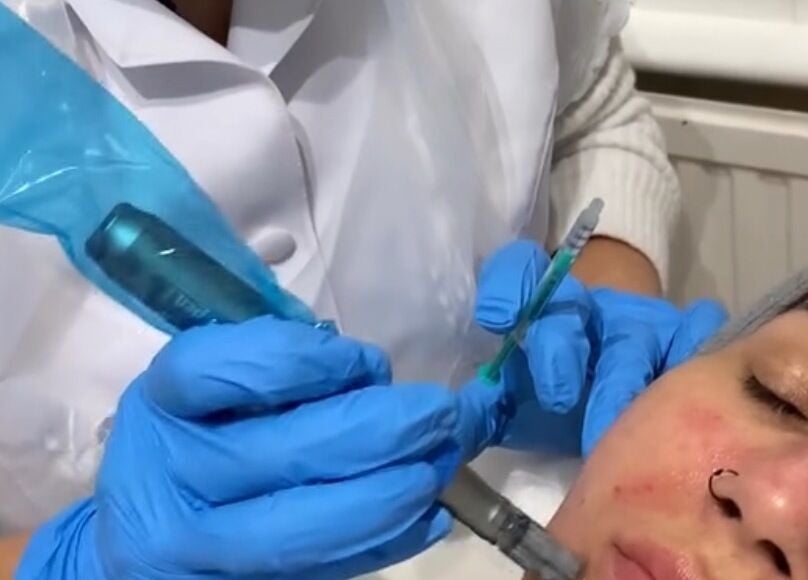 Facial treatment at Just Gorgeous by Paty Silva, London, England, GB, promoting skin rejuvenation.