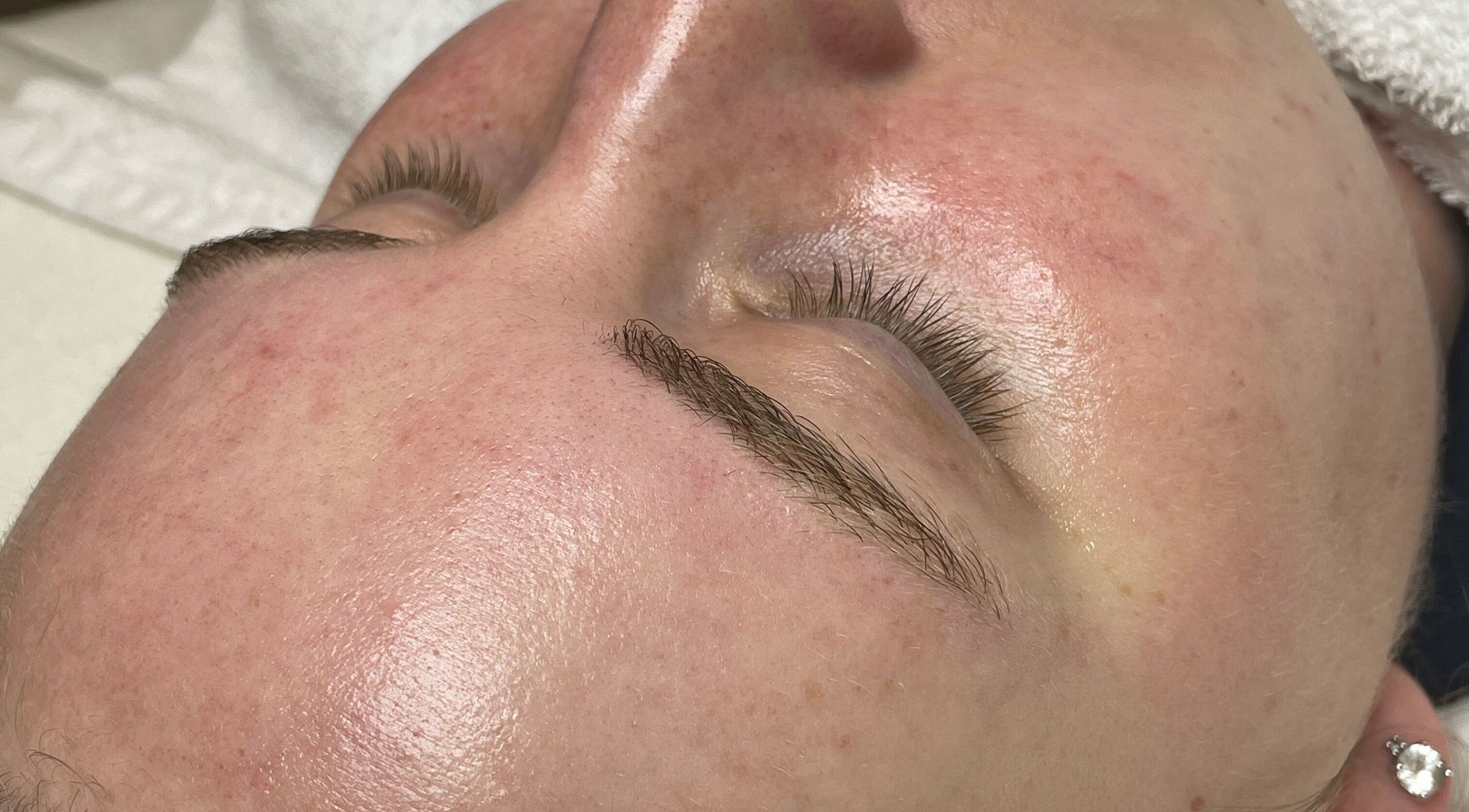 Close-up of a glowing face after treatment at Lavish Glow, Niagara Falls, Ontario, CA.