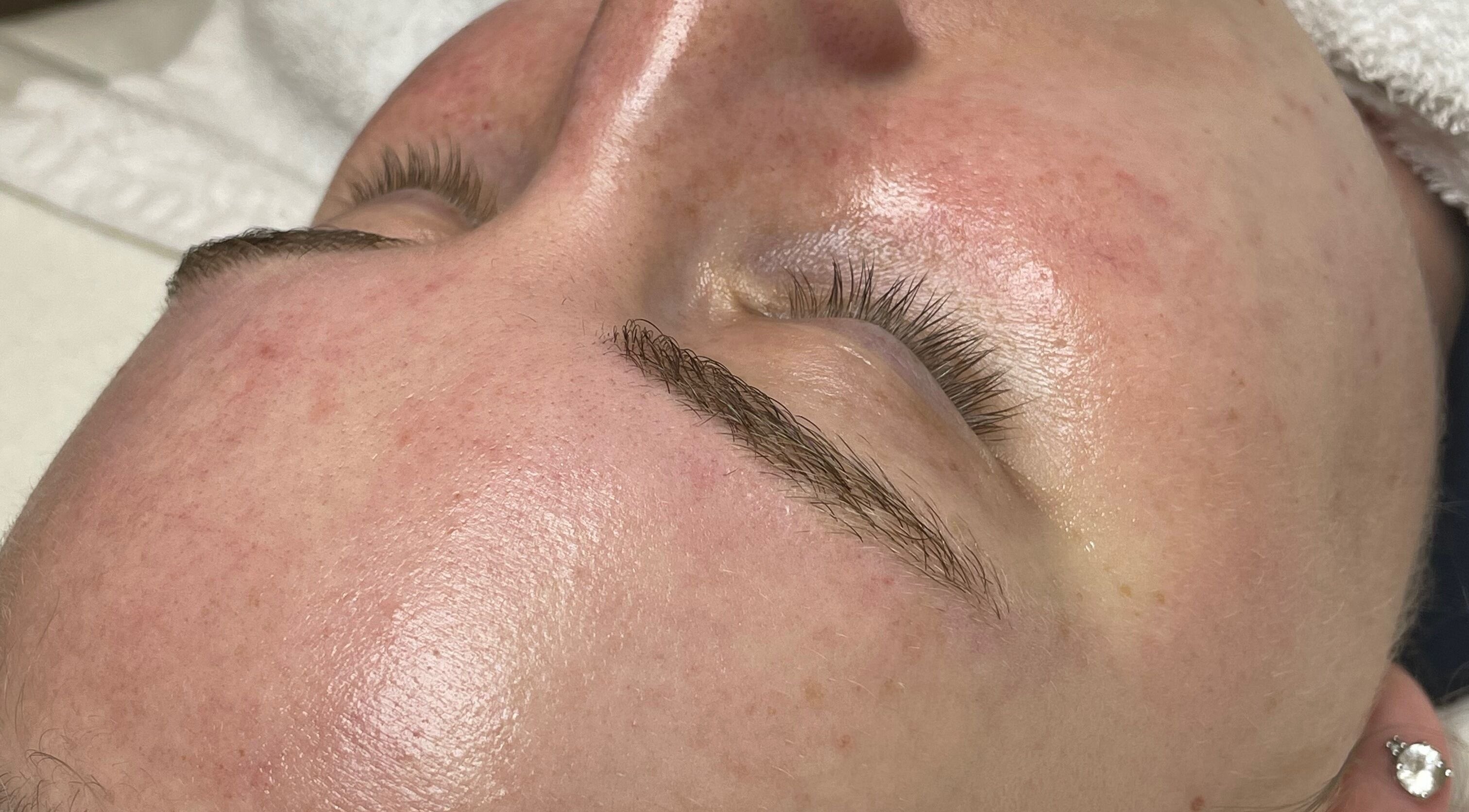 Close-up of a glowing face after treatment at Lavish Glow, Niagara Falls, Ontario, CA.