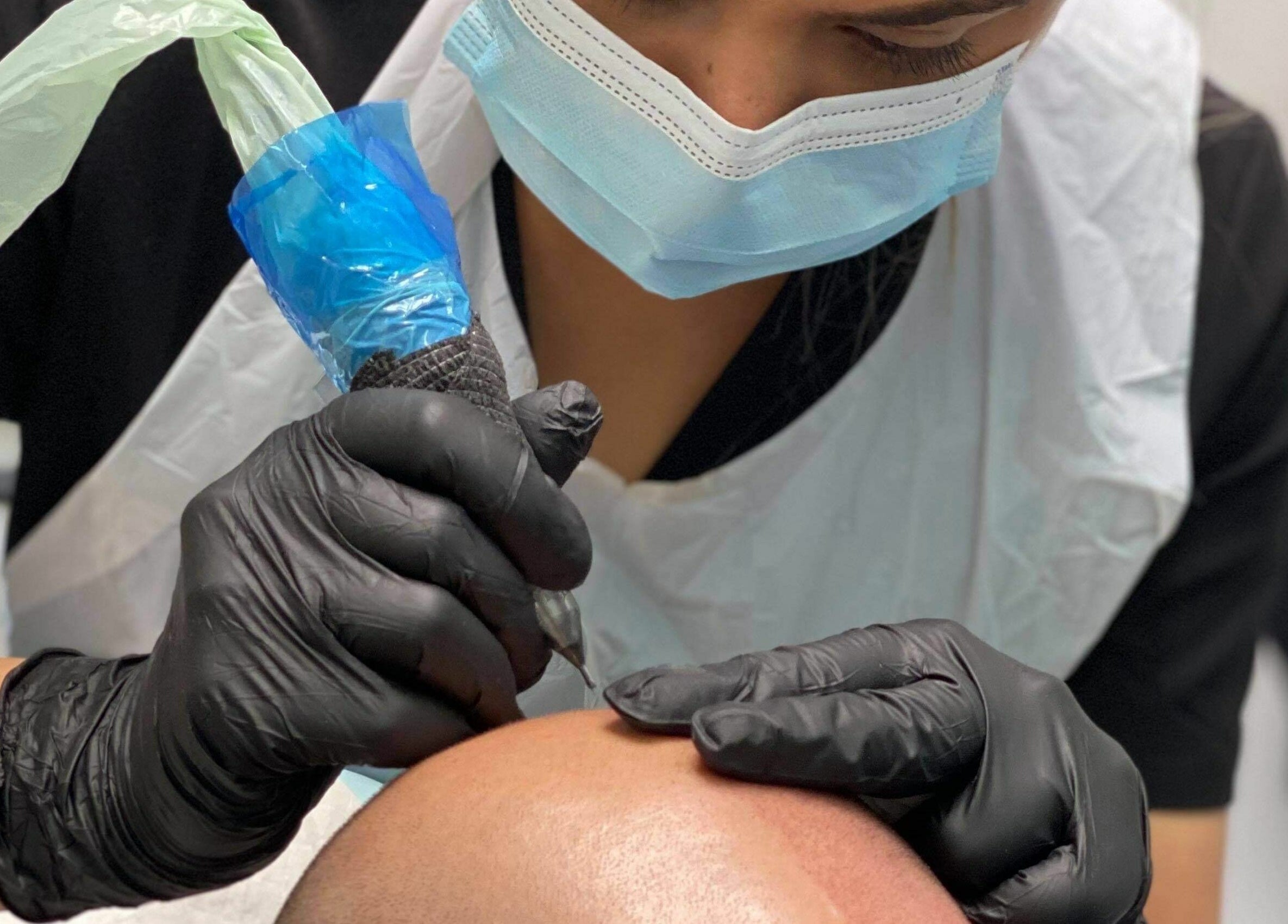 Artist performing scalp micropigmentation at Thread'In Shape - Caddens, Caddens, New South Wales, AU.