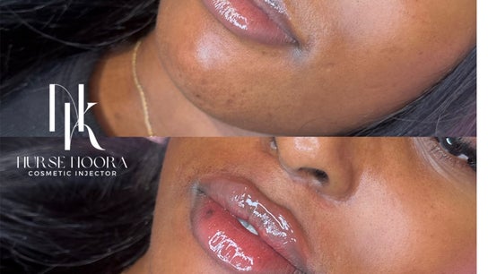 Face by Noora